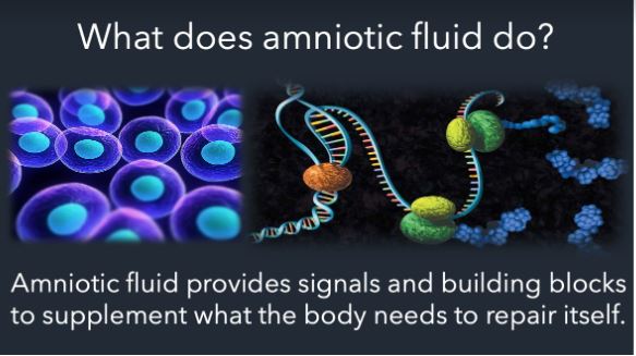 Amniotic fluid description