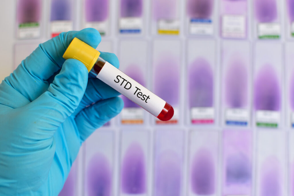 STD testing​